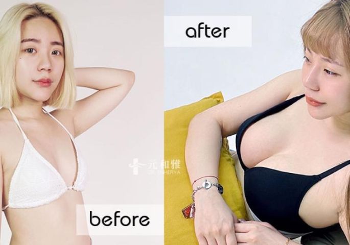 Motiva魔滴隆乳告別中性穿搭2.0，挺出酥胸女人味
