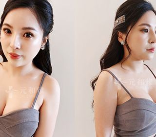 台南魔滴2.0隆乳價錢,魔滴2.0隆乳ptt,魔滴隆乳2.0費用,魔滴2.0隆乳缺點,魔滴2.0Dcard,魔滴隆乳2.0術後,魔滴隆乳2.0失敗,魔滴隆乳2.0手術術後恢復期心得日記魔滴2.0隆乳經驗分享 ,魔滴2.0隆乳費用價格,魔滴2.0隆乳推薦,魔滴2.0隆乳,motiva 2.0,JOY魔滴2.0,Motiva JOY Ergonomix2,魔滴2.0