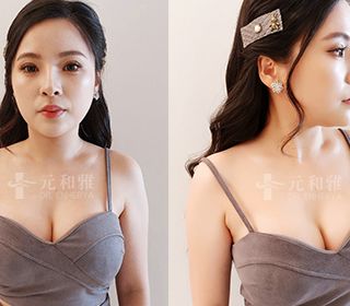台南魔滴2.0隆乳價錢,魔滴2.0隆乳ptt,魔滴隆乳2.0費用,魔滴2.0隆乳缺點,魔滴2.0Dcard,魔滴隆乳2.0術後,魔滴隆乳2.0失敗,魔滴隆乳2.0手術術後恢復期心得日記魔滴2.0隆乳經驗分享 ,魔滴2.0隆乳費用價格,魔滴2.0隆乳推薦,魔滴2.0隆乳,motiva 2.0,JOY魔滴2.0,Motiva JOY Ergonomix2,魔滴2.0